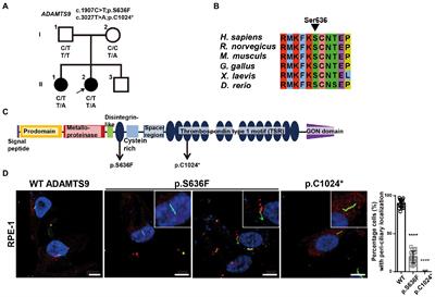 Disease modeling of ADAMTS9-related nephropathy using kidney organoids reveals its roles in tubular cells and podocytes